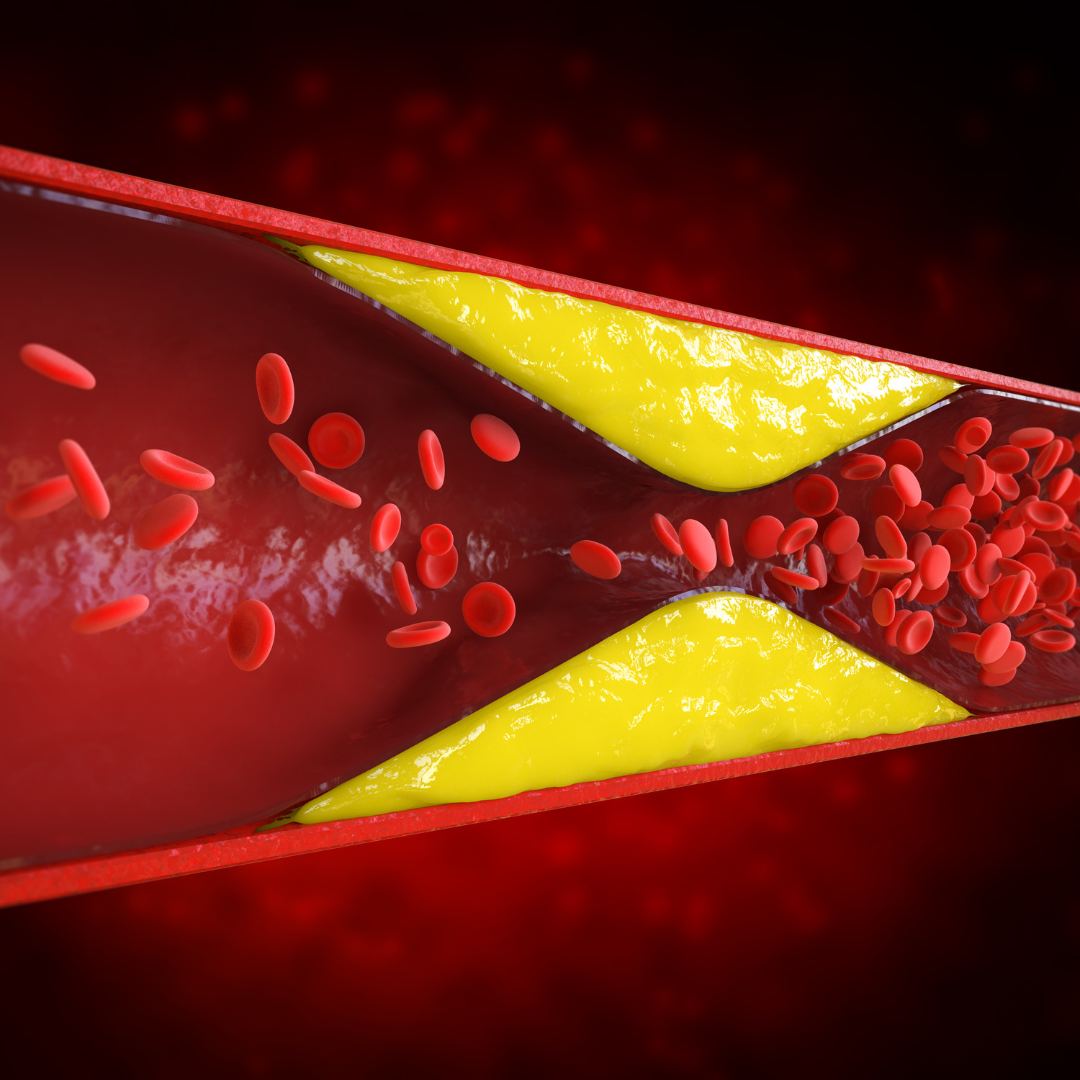 100% Smart Omega 3 - 100 softgel kapsula - Slika 21